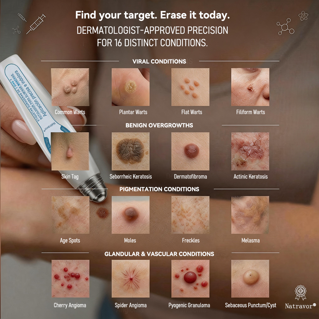 👑𝐎𝐟𝐟𝐢𝐜𝐢𝐚𝐥 𝐁𝐫𝐚𝐧𝐝 𝐒𝐭𝐨𝐫𝐞 |✅👩‍⚕️Natravor® 7-𝐷𝑎𝑦 𝗧𝐚𝐠 & 𝗦𝗽𝐨𝐭 𝐄𝐫𝒂𝒔𝒆𝒓(Zero Pain, Zero 𝐒𝐜𝐚𝒓𝒔 Rollerball)e