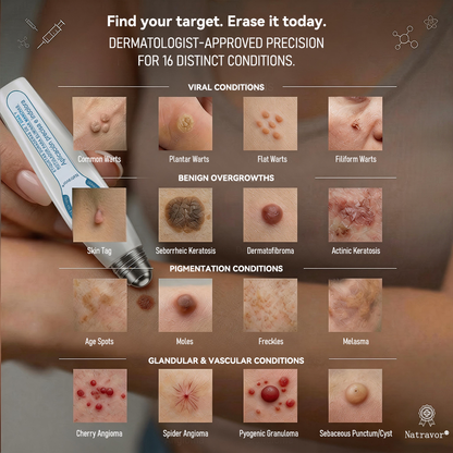 👑𝐎𝐟𝐟𝐢𝐜𝐢𝐚𝐥 𝐁𝐫𝐚𝐧𝐝 𝐒𝐭𝐨𝐫𝐞 |✅👩‍⚕️Natravor® 7-𝐷𝑎𝑦 𝗧𝐚𝐠 & 𝗦𝗽𝐨𝐭 𝐄𝐫𝒂𝒔𝒆𝒓(Zero Pain, Zero 𝐒𝐜𝐚𝒓𝒔 Rollerball)e