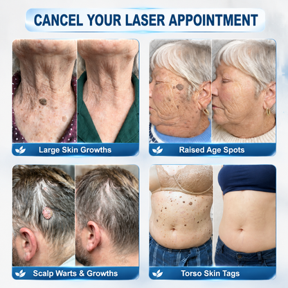 👑Natravor® 7-𝐃𝐚𝐲 𝐒𝐤𝐢𝐧 𝐓𝐚𝐠 & 𝐒𝐩𝐨𝐭 𝐄𝐫𝐚𝐬𝐞𝐫 𝐂𝐫𝐞𝐚𝐦 (Zero Pain, Zero 𝐒𝐜𝐚𝐫𝐬 Formula) 💎