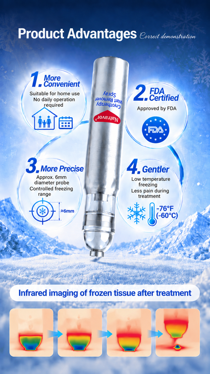 Zero Pain💎Natravor® Cryotherapy Wart Remover Spray（Botanical Extracts · Advanced Cryotherapy Technology · Targeted Care for Warts & Skin Bumps）
